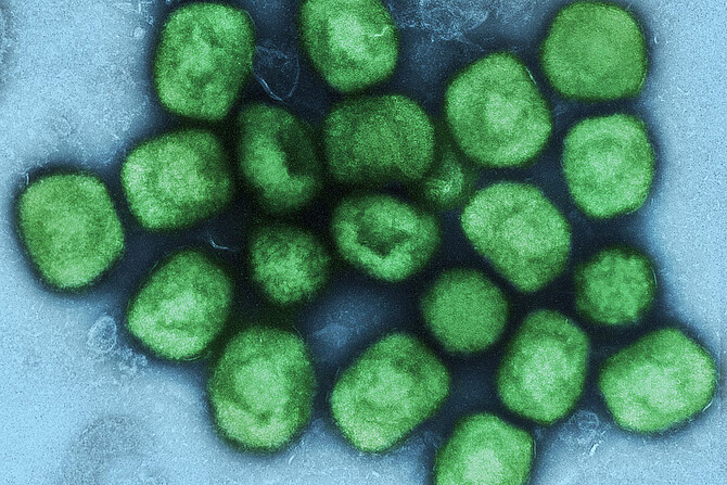 Mpox-Viruspartikel, grün eingefärbt