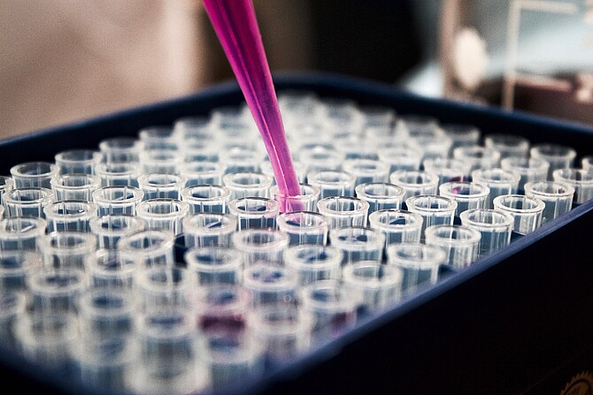 Pipette_Reagenzglas_LouisReed