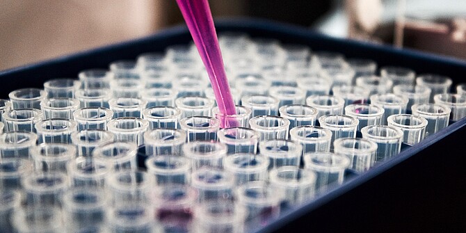 Pipette_Reagenzglas_LouisReed